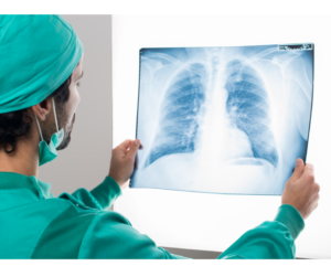 Doctor reviewing chest x-ray on lightbox