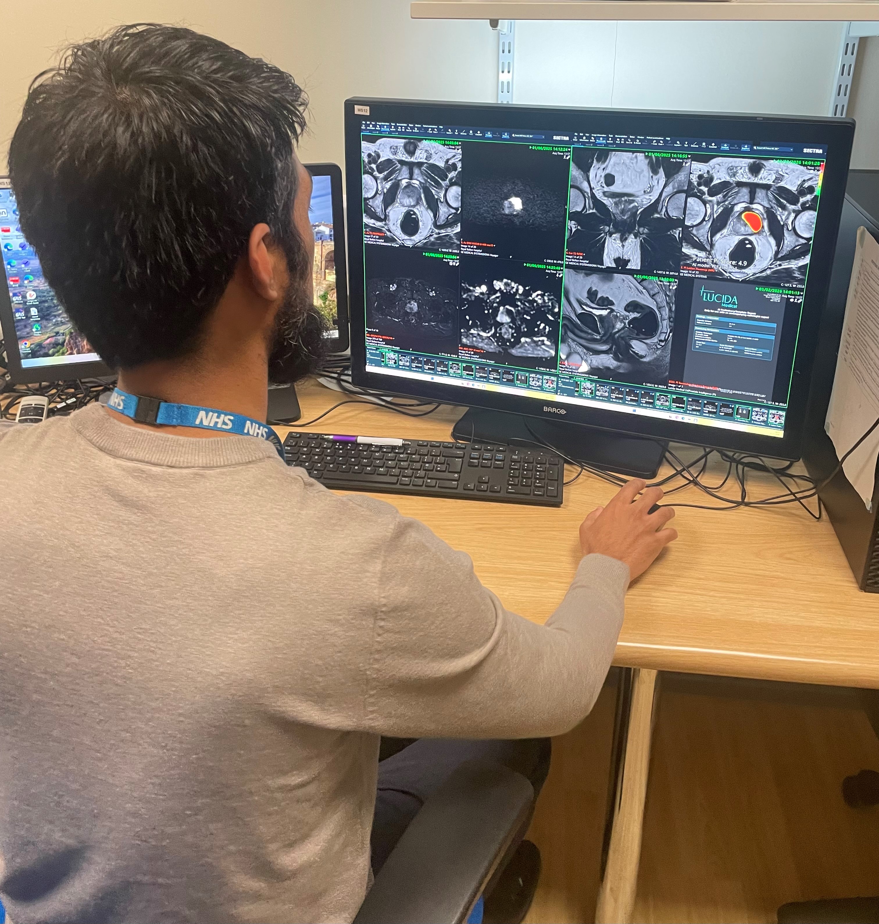 Mohammed-Abdulla-from-Bolton-Hospital-at-a-workstation-using-the-prostate-MRI-technology